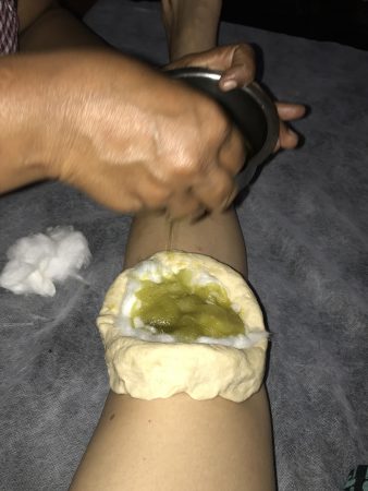 アーユルヴェーダ　パンチャカルマ